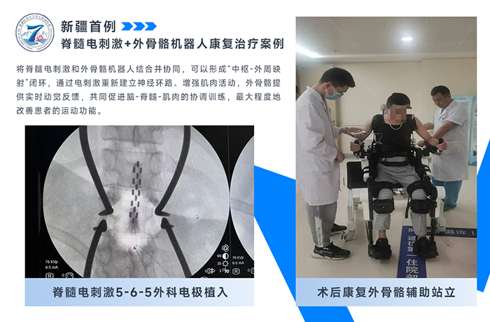新疆醫(yī)科大學(xué)第七附屬醫(yī)院分享首例脊髓電刺激+外骨骼治療！